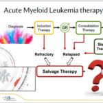 The current image has no alternative text. The file name is: AML-therapy.jpg